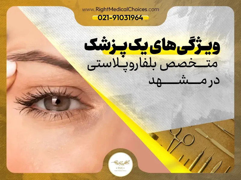 بهترین دکتر بلفاروپلاستی در مشهد: ویژگی‌ها و صلاحیت‌ها