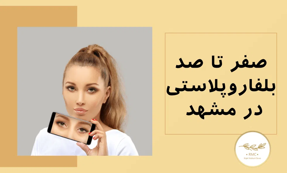 جراحی پلک در مشهد و انتخاب بهترین جراح بلفاروپلاستی