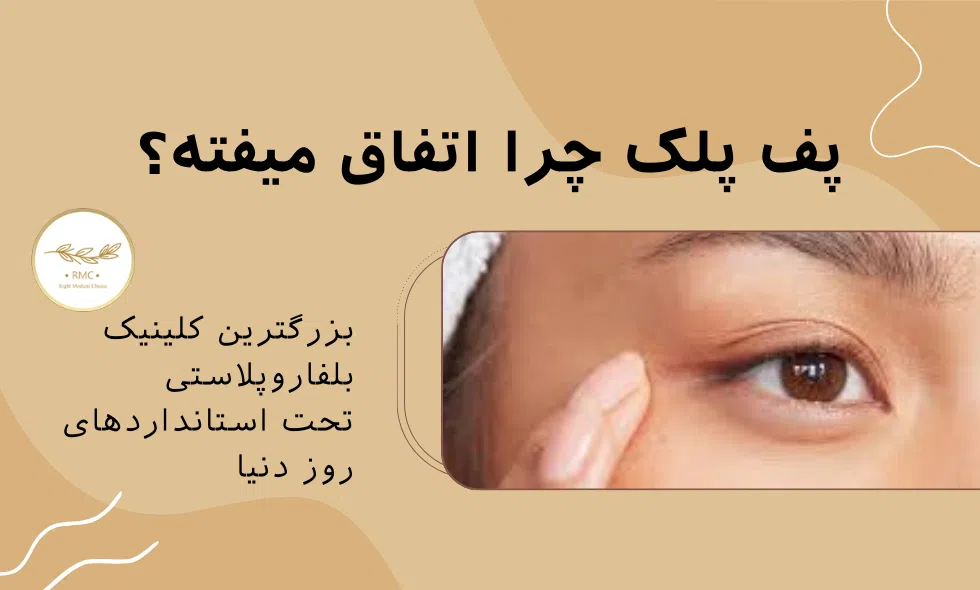 پف پلک با جراحی پلک درست میشه؟ بررسی در کلینیک نور