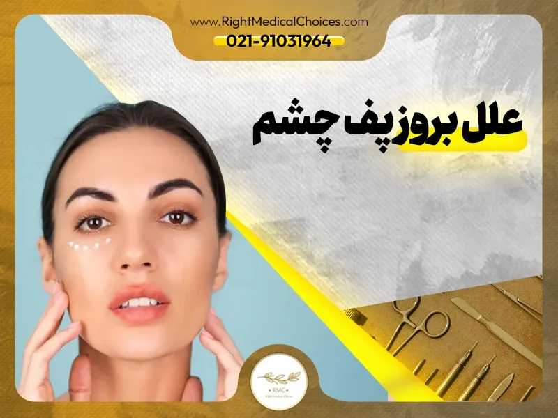 روش‌های خانگی برای درمان پف چشم: از خیار تا چای کیسه‌ای
