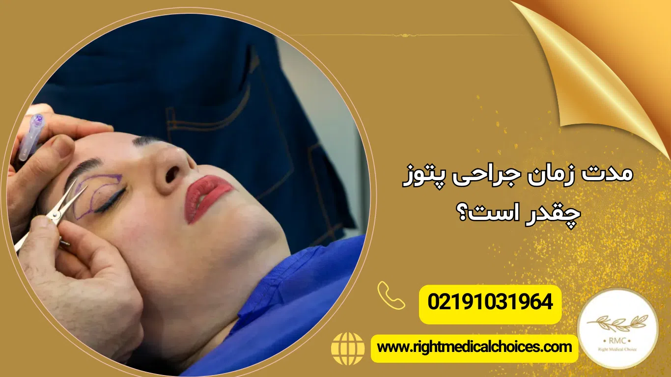 پاسخ به سوال مهم: جراحی پتوز چقدر طول می کشد و آیا بیهوشی دارد؟