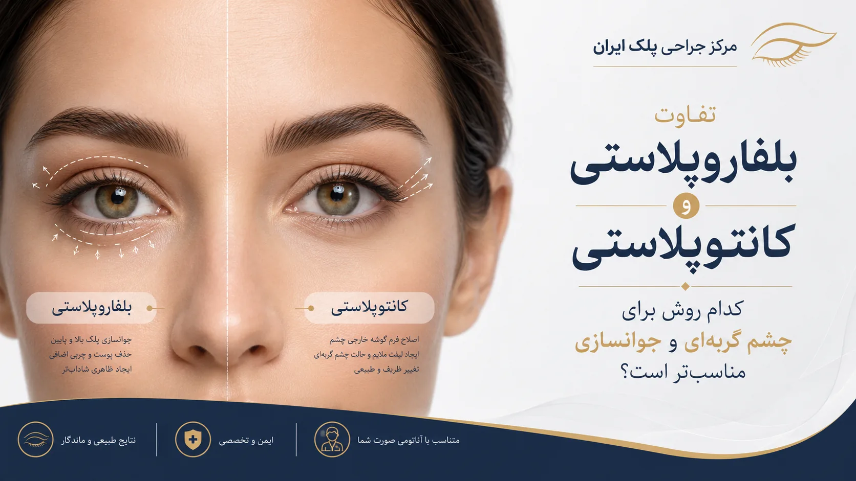تفاوت بلفاروپلاستی و کانتوپلاستی: کدام روش برای چشم گربه‌ای و جوانسازی مناسب‌تر است؟