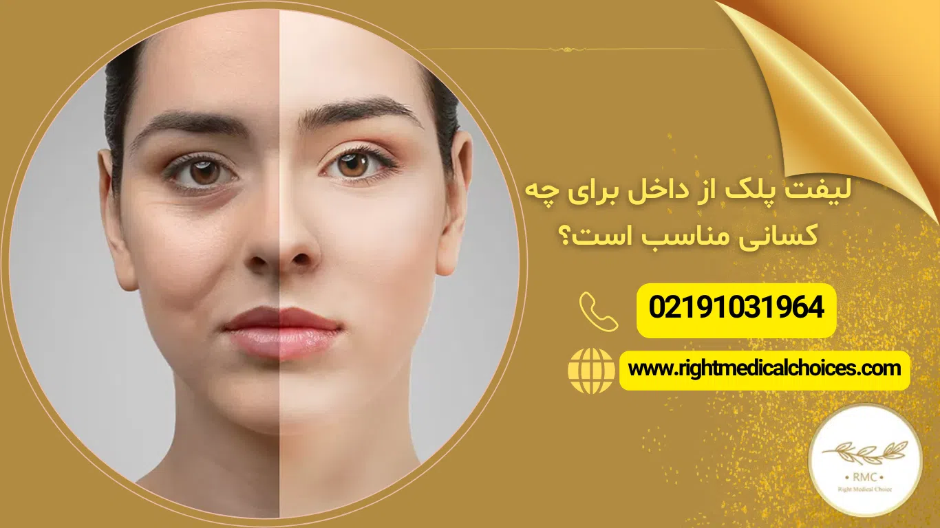مزیت ها ومعایب که باید در روش جراحی پلک از داخل بدانید + چیستن؟