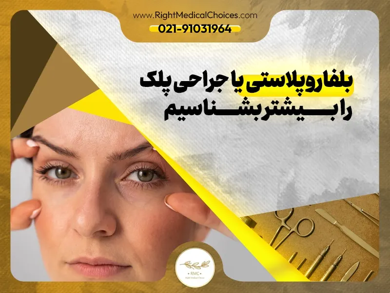 معرفی دکتر آرش نجف بیگی متخصص بلفاروپلاستی