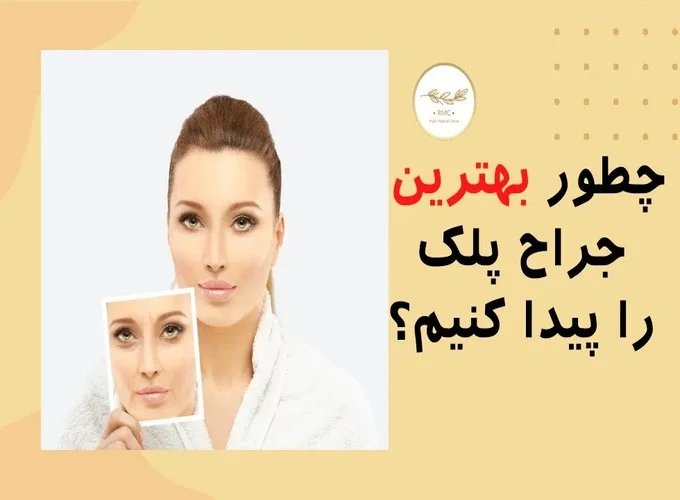 بهترین جراح پلک در کرمانشاه