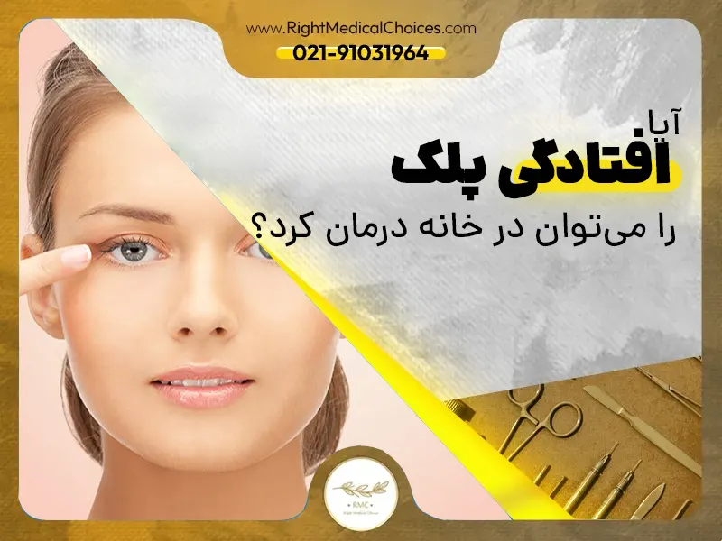 روش درمان پتوز یا فلج پلکی به صورت خانگی وجود دارد؟