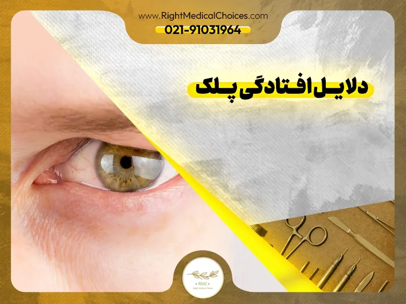 جراحی پلک با لیزر: بهترین گزینه برای رفع افتادگی پلک