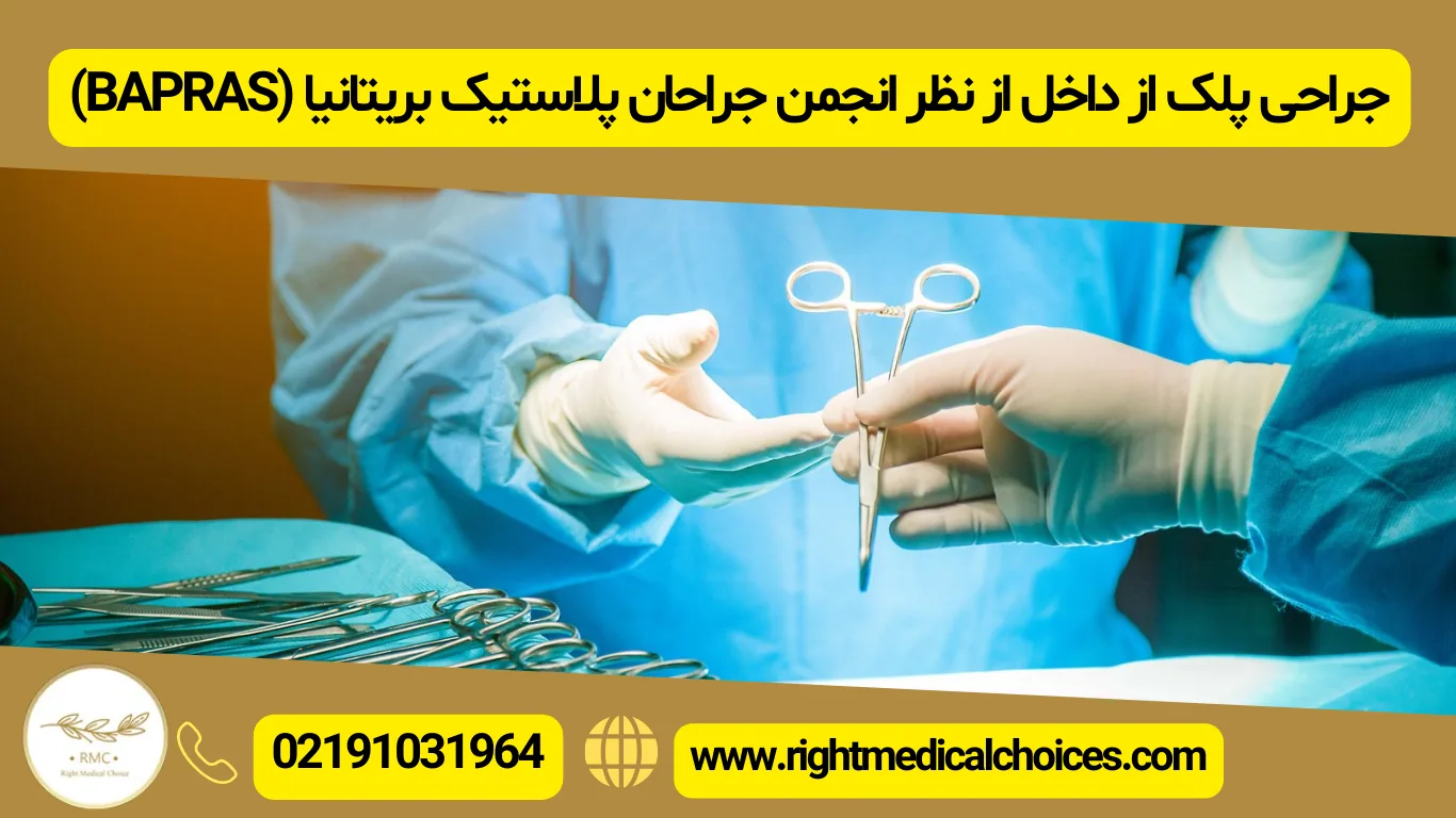 مناسب‌ترین سن برای جراحی پلک از داخل