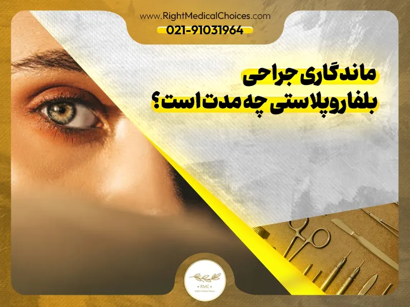 ماندگاری جراحی بلفاروپلاستی چه مدت است؟