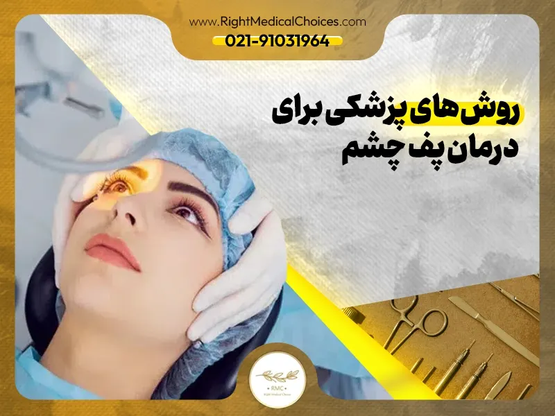 روش‌های پزشکی برای درمان پف چشم