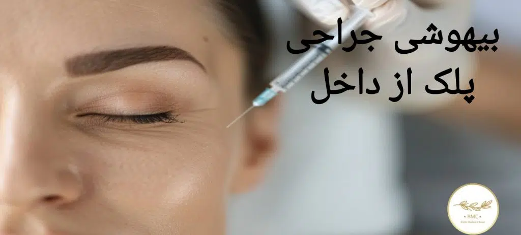 بیهوشی جراحی پلک از داخل