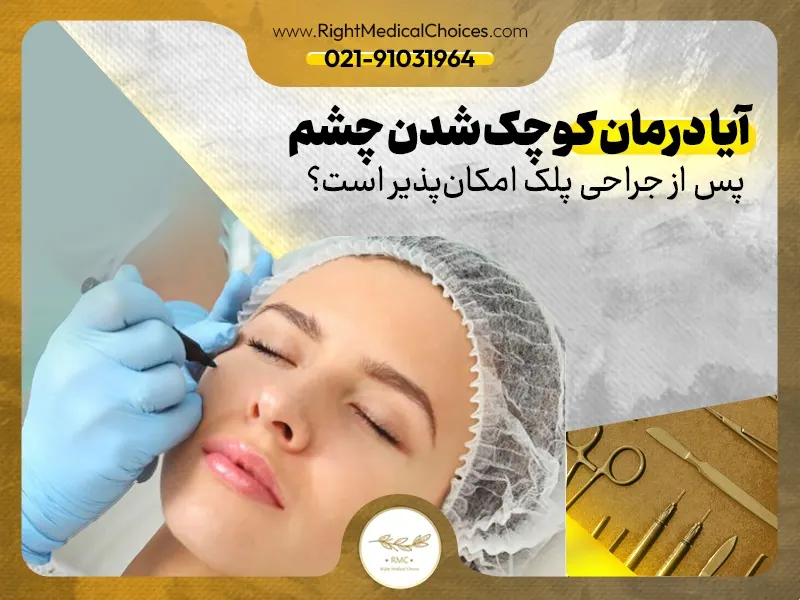 آیا درمان کوچک شدن چشم پس از جراحی پلک امکان‌پذیر است؟
