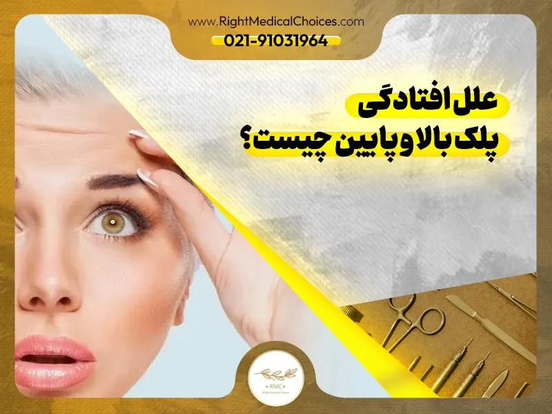 علل افتادگی پلک بالا و پایین چیست؟