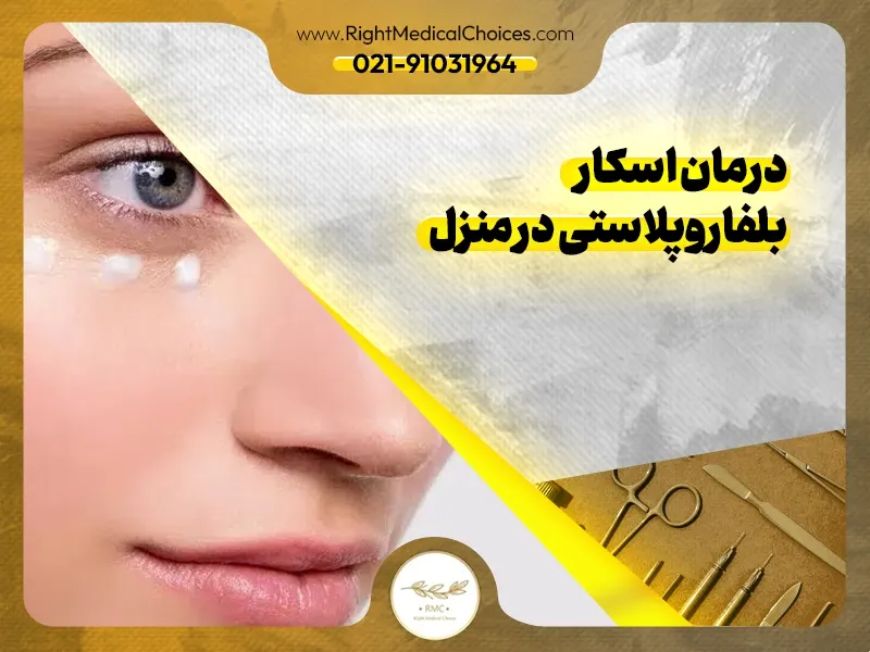 درمان اسکار بلفاروپلاستی در منزل