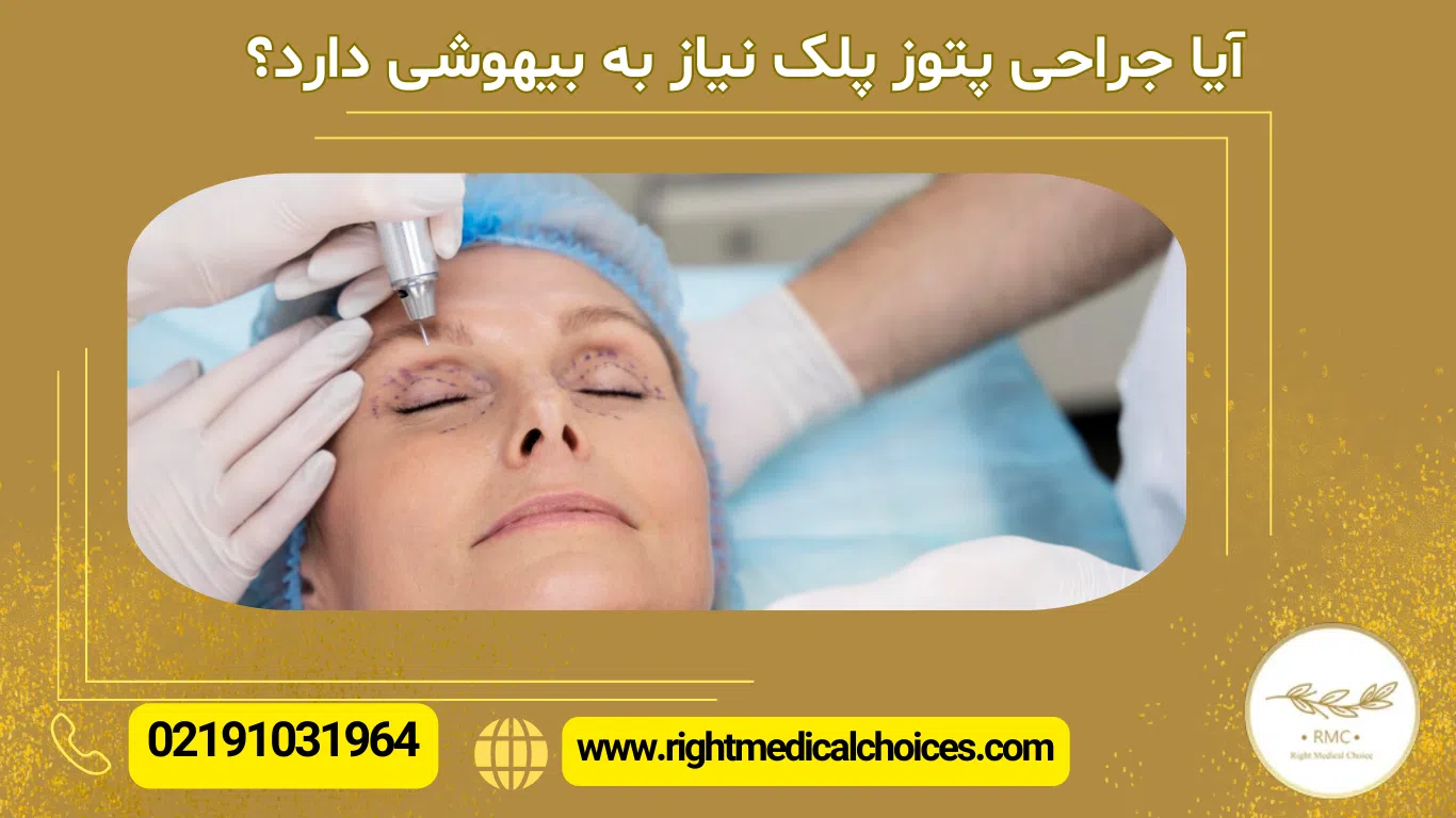 آیا جراحی پتوز نیاز به بیهوشی دارد