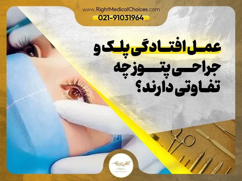 عمل افتادگی پلک و جراحی پتوز چه تفاوتی دارند؟