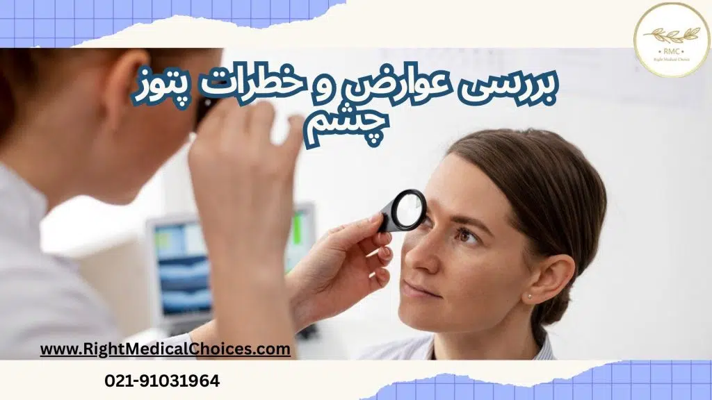 بررسی عوارض و خطرات پتوز چشم