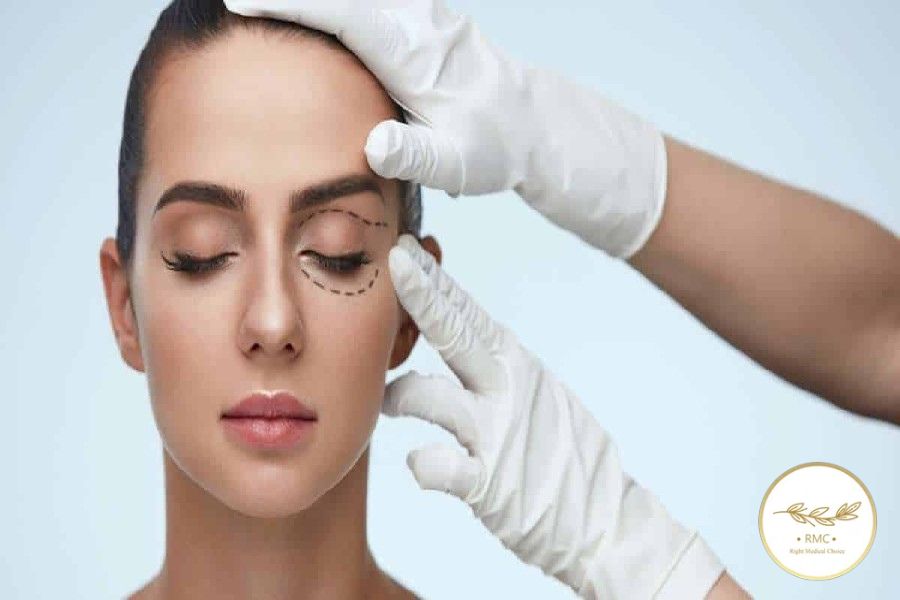 مقایسه مدت زمان نقاهت ترانس کونژ با سایر روش‌های جراحی پلک پایین