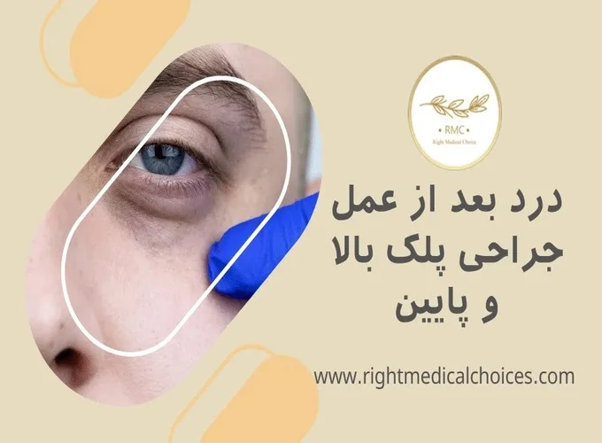 درد چشم و آبریزش شدید