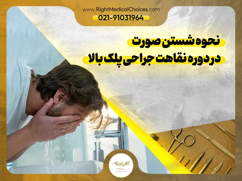 نحوه شستن صورت در دوره نقاهت جراحی پلک بالا