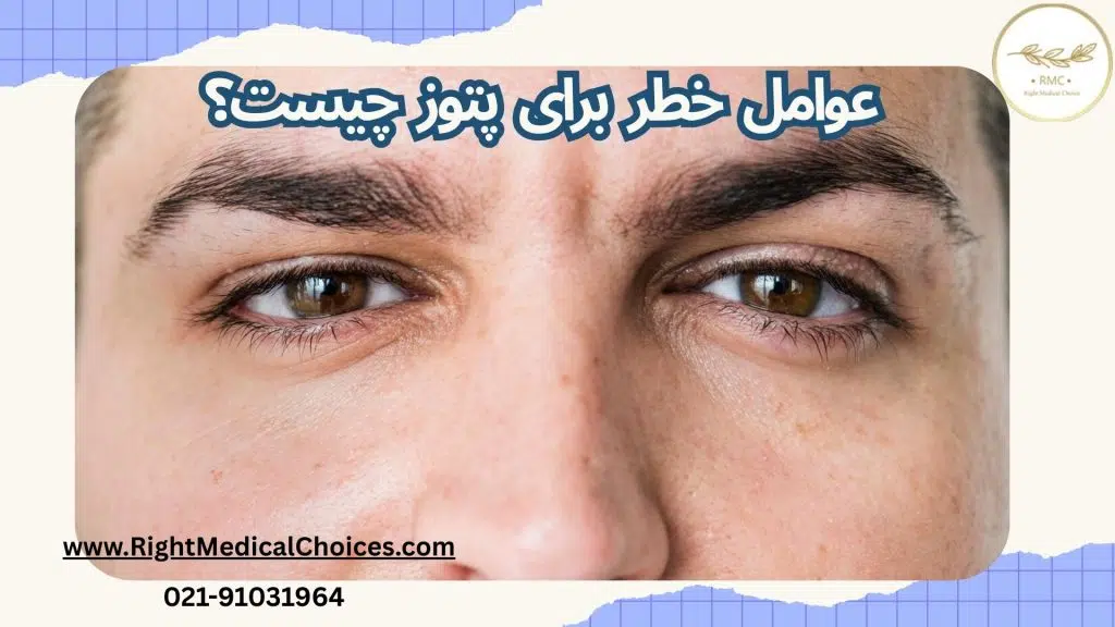 عوامل خطر برای پتوز چیست _ خطرات پتوز