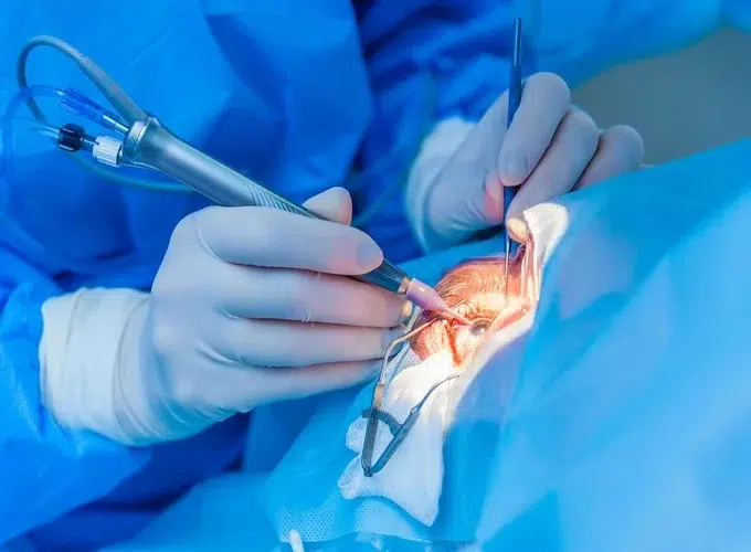 رده سنی مناسب برای جراحی اکتروپیون