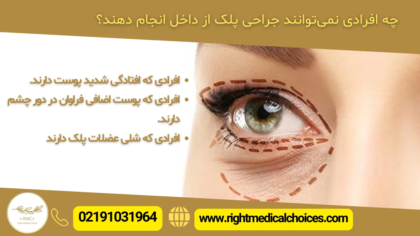 جراحی پلک از داخل