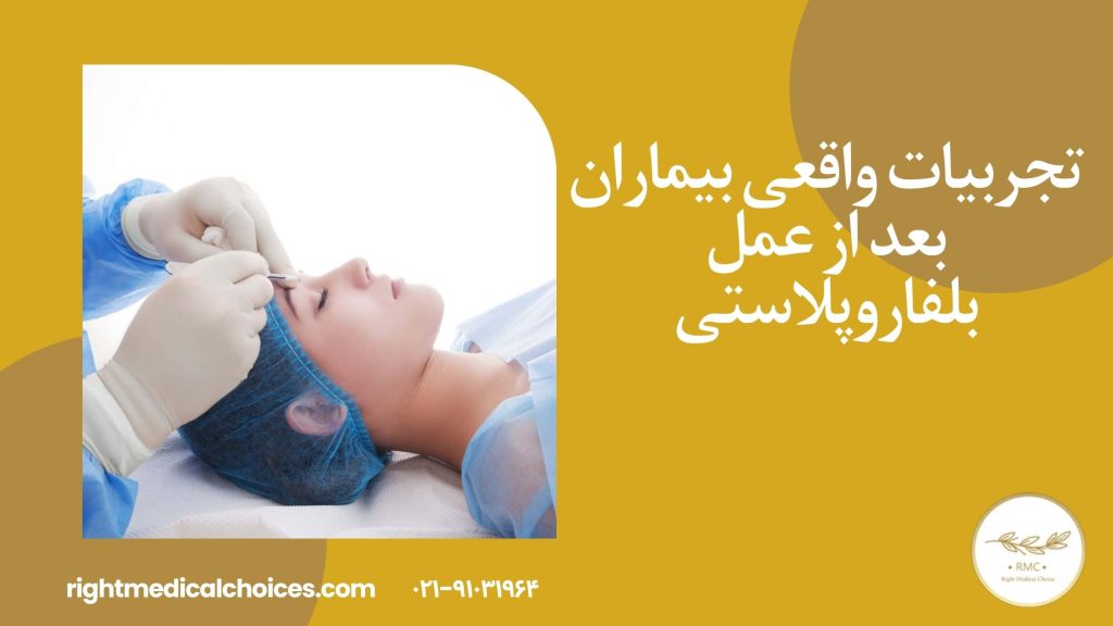 تجربیات واقعی بیماران بعد از عمل بلفاروپلاستی