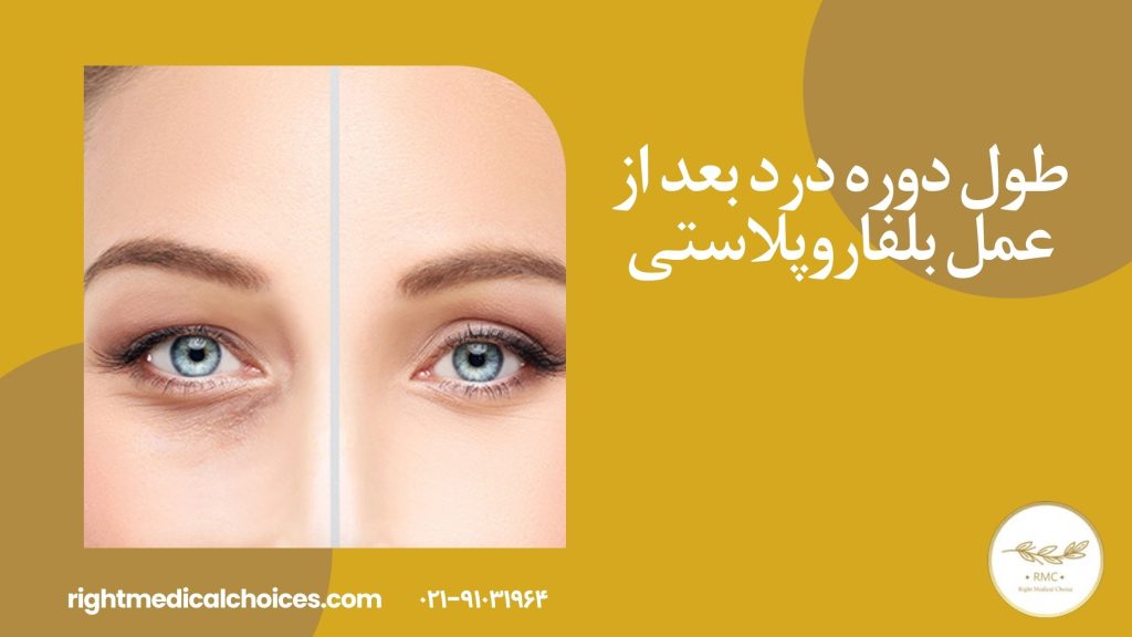 طول دوره درد بعد از عمل بلفاروپلاستی