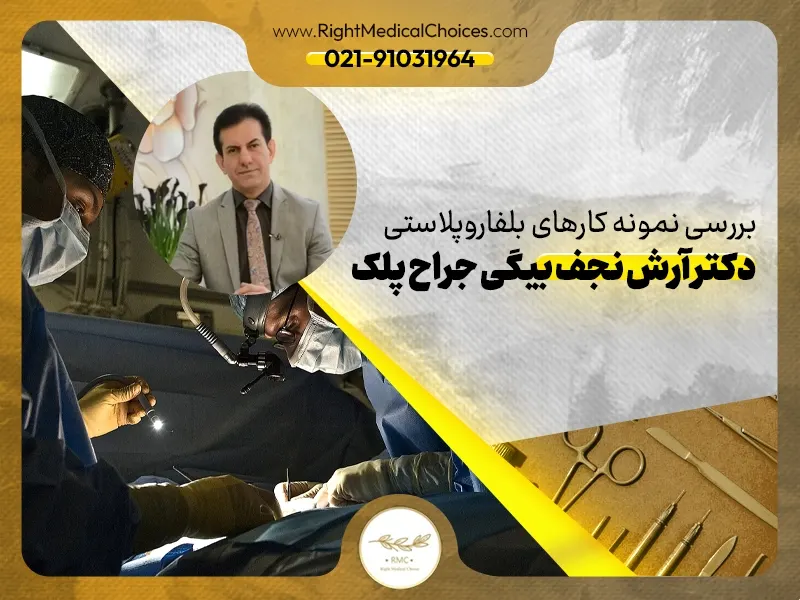 بررسی نمونه کارهای بلفاروپلاستی دکتر آرش نجف بیگی جراح پلک