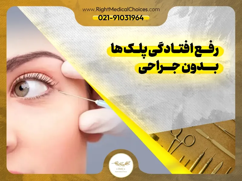 رفع افتادگی پلک ها بدون جراحی
