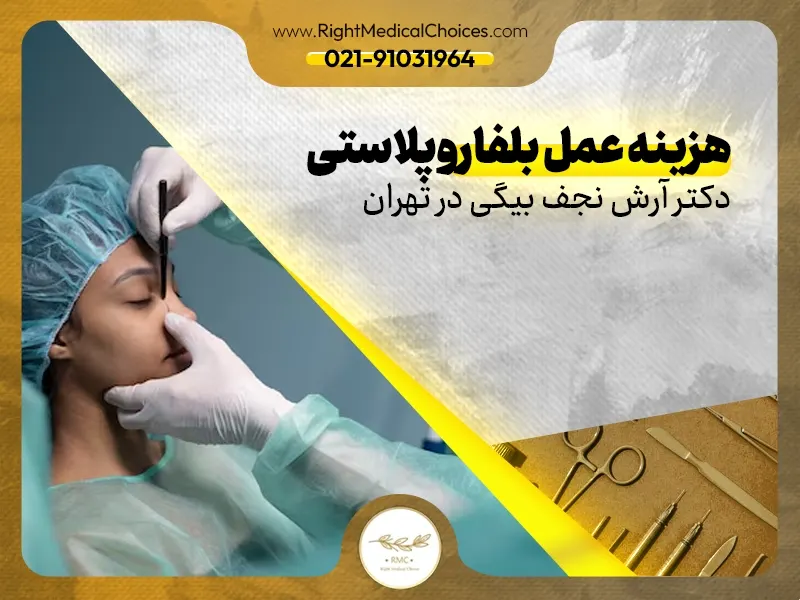 هزینه عمل بلفاروپلاستی دکتر آرش نجف بیگی در تهران