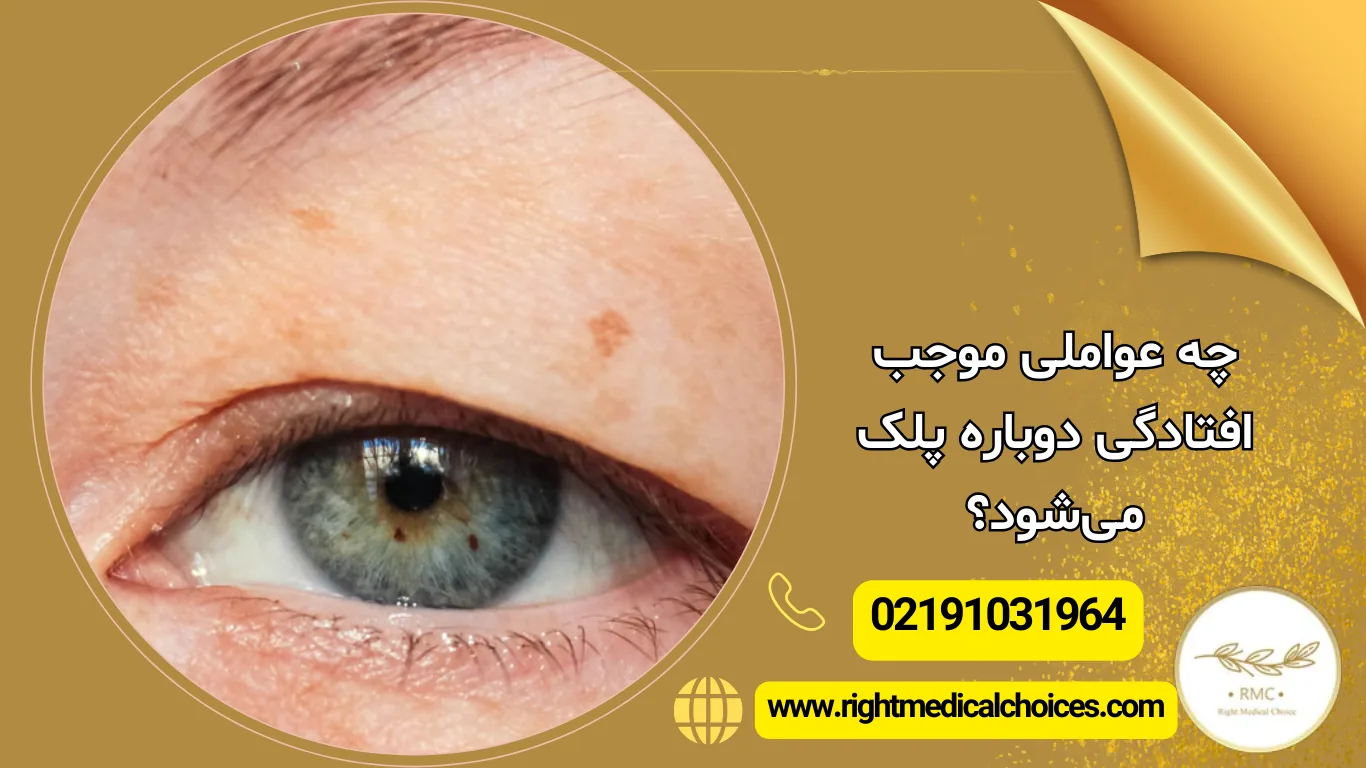 چه عواملی موجب افتادگی دوباره پلک می شود؟