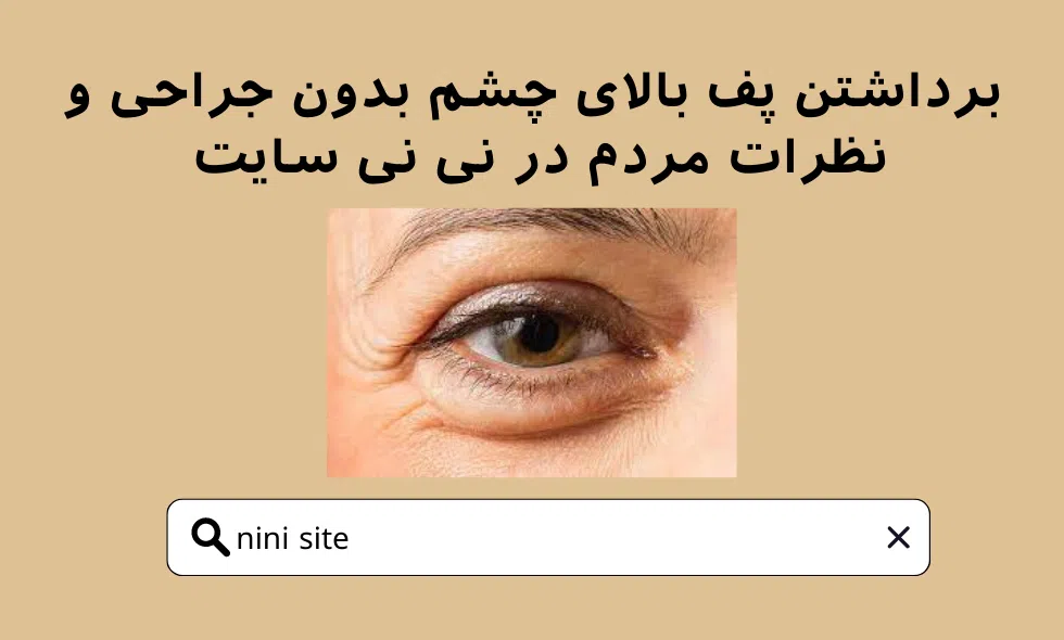 برداشتن پف بالای چشم بدون جراحی در نی نی سایت