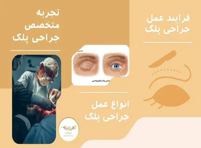 فاکتورهای موثر بر هزینه عمل بلفاروپلاستی یا جراحی پلک در کامرانیه