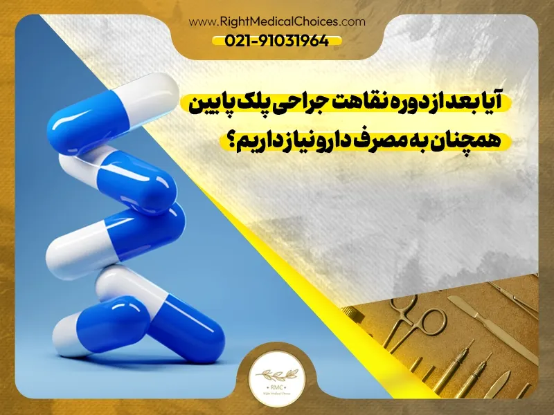 آیا بعد از دوره نقاهت جراحی پلک پایین همچنان به مصرف دارو نیاز داریم؟