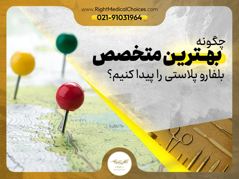 چگونه بهترین متخصص بلفاروپلاستی در تهران را پیدا کنیم؟