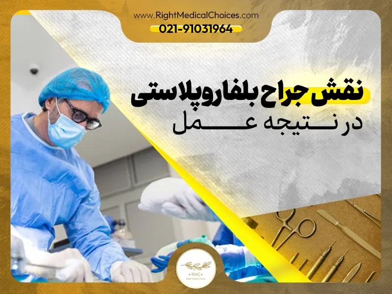 نقش جراح بلفاروپلاستی در نتیجه عمل
