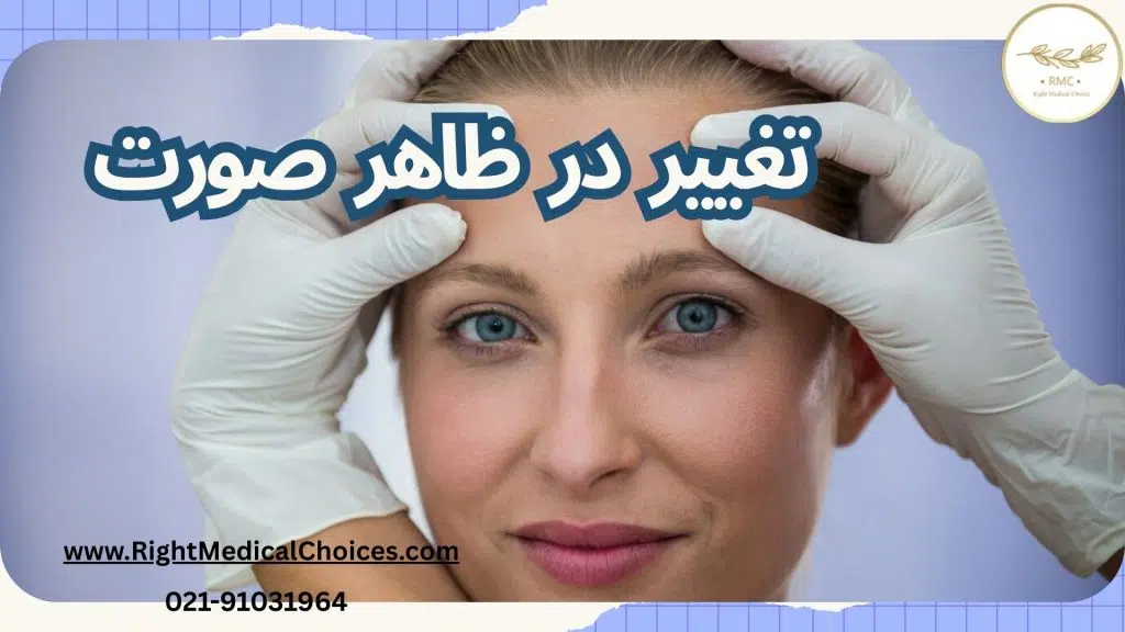 علامت هشداردهنده پتوز چشم: تغییر در ظاهر صورت