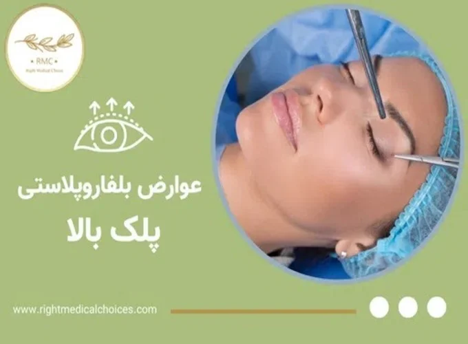 روش‌های کاهش عوارض بلفاروپلاستی پلک بالا
