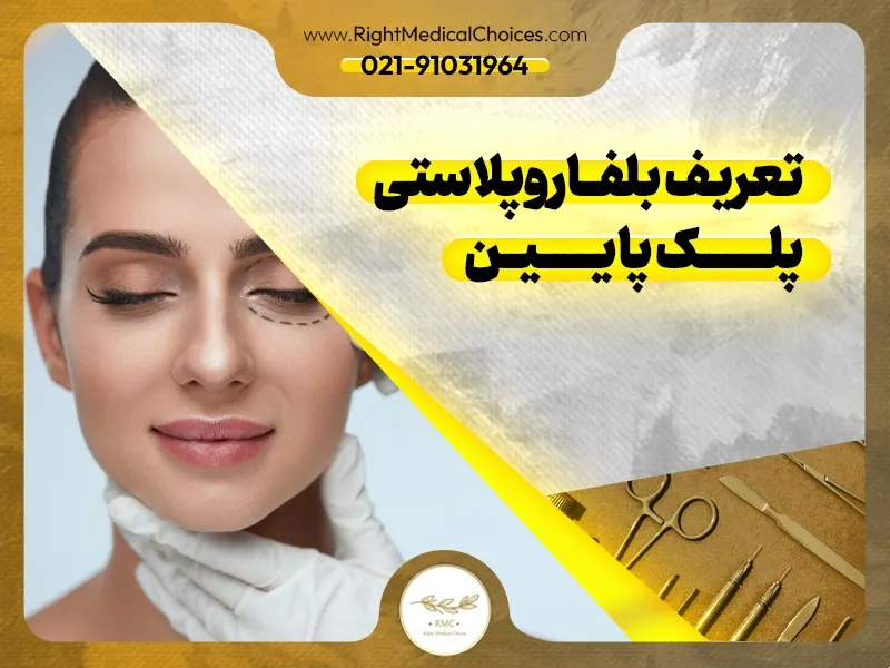 تعریف بلفاروپلاستی پلک پایین