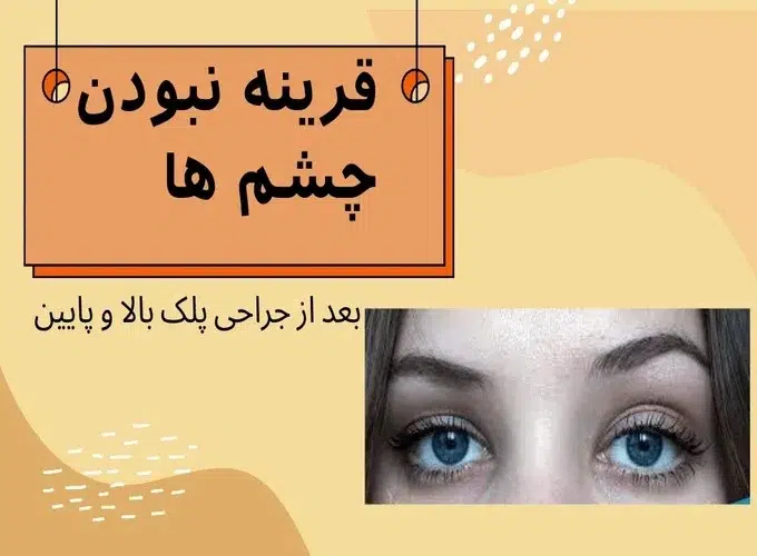 قرینه نبودن چشم‌ها