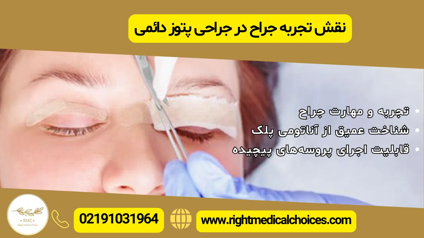 بهترین جراح پتوز پلک ایران