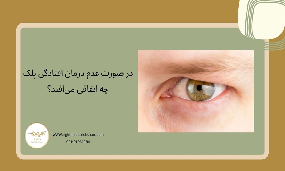 خطاهای رایج در تشخیص پتوز: چگونه از اشتباهات پزشکی جلوگیری کنیم؟