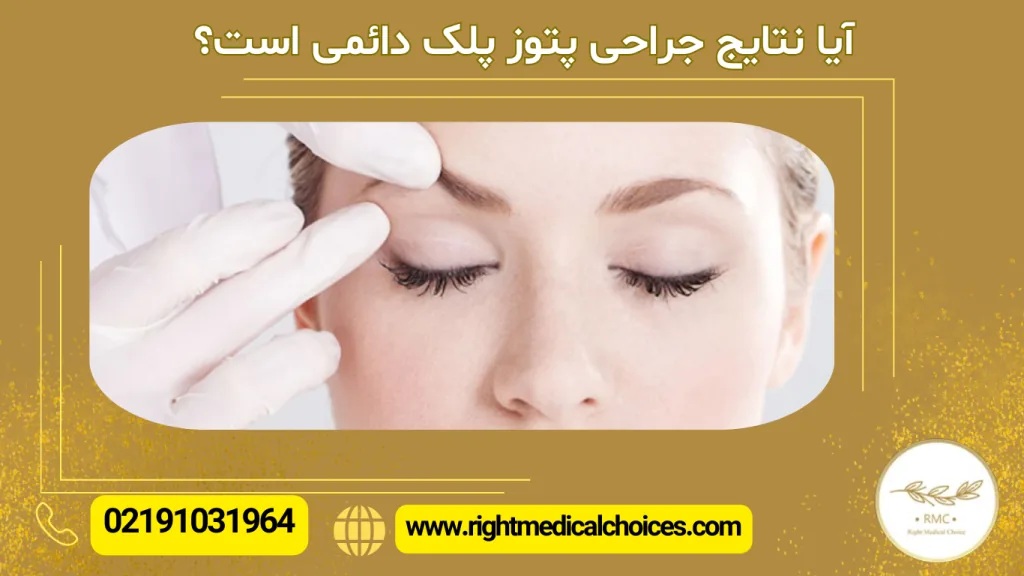 آیا نتایج جراحی پتوز پلک دائمی است؟