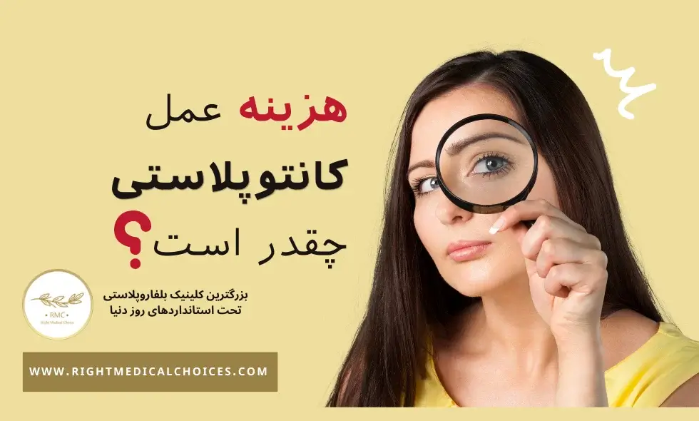 هزینه عمل کانتوپلاستی به چه صورت است؟