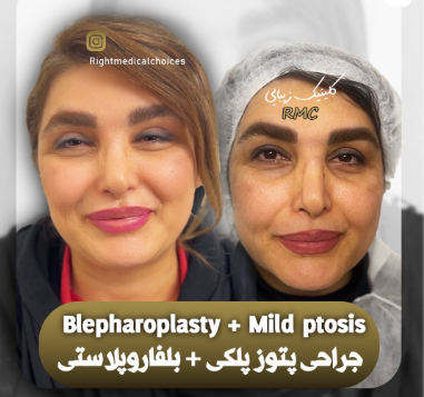 اینستاگرام ۲