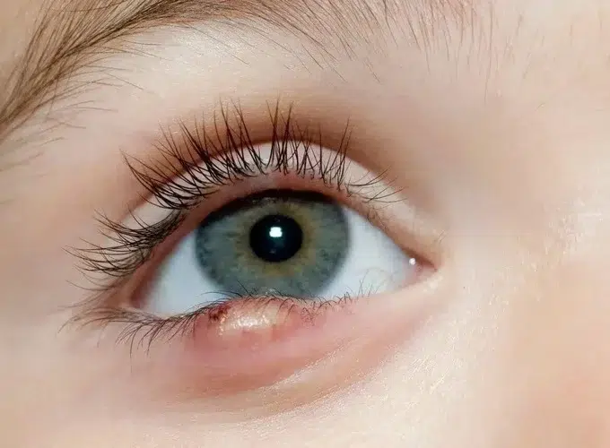 ۳