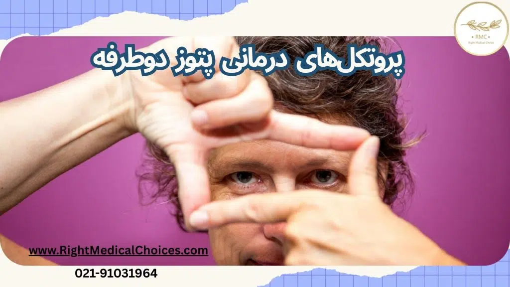 تفاوت درمان پتوز یکطرفه با دوطرفه 