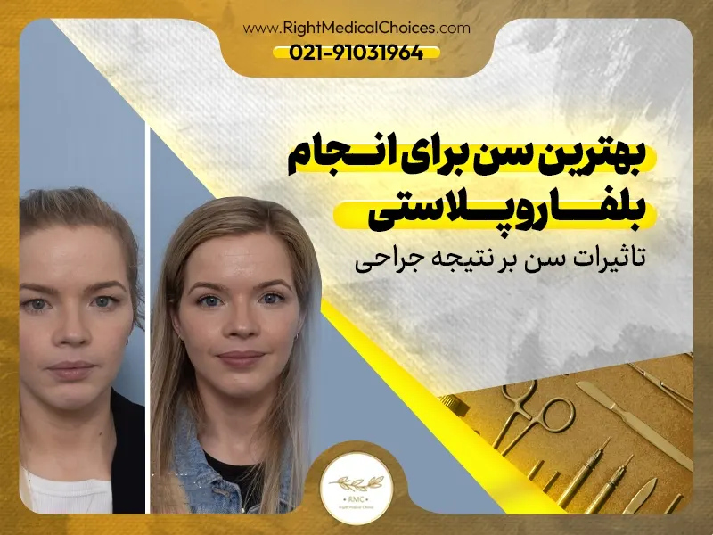 بهترین سن برای انجام بلفاروپلاستی: تاثیرات سن بر نتیجه جراحی